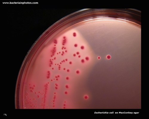 escherichia coli colonies on MacConkey agar